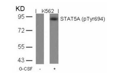 Western Blot: STAT5A [p Tyr694] Antibody [NB100-82219]